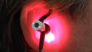Low-Level-Laser: Das Tinnitus-Heilmittel?