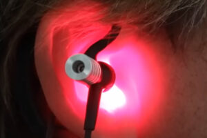 Low-Level-Laser: Das Tinnitus-Heilmittel?